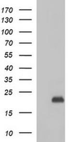 PLA2G16 Antibody in Western Blot (WB)