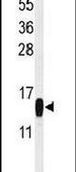 PLA2 Antibody in Western Blot (WB)