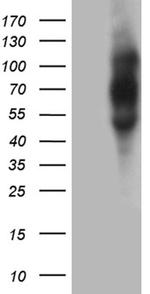 PLA2G3 Antibody in Western Blot (WB)