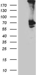 PLA2G3 Antibody in Western Blot (WB)