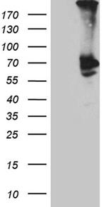 PLA2G3 Antibody in Western Blot (WB)