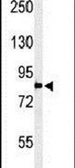 PLA2G4B Antibody in Western Blot (WB)