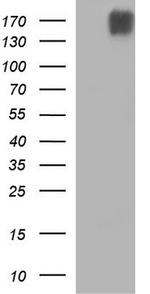 PLB1 Antibody in Western Blot (WB)