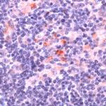 PLCG2 Antibody in Immunohistochemistry (IHC)