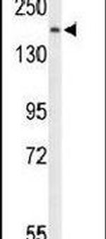 PLCB1 Antibody in Western Blot (WB)