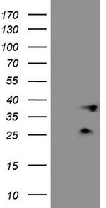 PLCXD1 Antibody in Western Blot (WB)