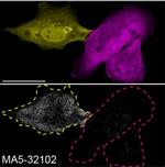 Plectin Recombinant Rabbit Monoclonal Antibody (SY29-04)
