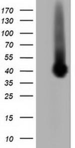 PLEK Antibody in Western Blot (WB)