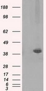 PLEK Antibody in Western Blot (WB)