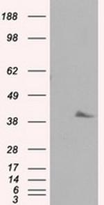 PLEK Antibody in Western Blot (WB)