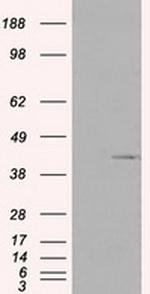 PLEK Antibody in Western Blot (WB)