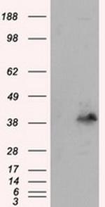 PLEK Antibody in Western Blot (WB)