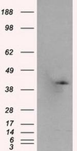 PLEK Antibody in Western Blot (WB)