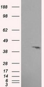 PLEK Antibody in Western Blot (WB)