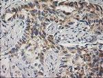 PLEKHA3 Antibody in Immunohistochemistry (Paraffin) (IHC (P))