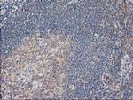 PLEKHA3 Antibody in Immunohistochemistry (Paraffin) (IHC (P))
