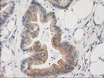 PLEKHA3 Antibody in Immunohistochemistry (Paraffin) (IHC (P))