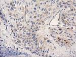 PLEKHA3 Antibody in Immunohistochemistry (Paraffin) (IHC (P))