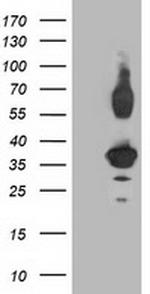 PLEKHA3 Antibody in Western Blot (WB)