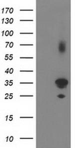 PLEKHA3 Antibody in Western Blot (WB)