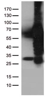 PLK1 Antibody in Western Blot (WB)