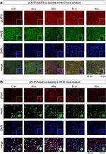 PLK1 Antibody in Immunohistochemistry (IHC)