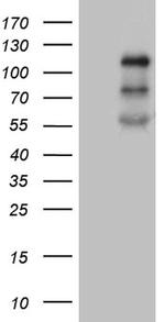 PLK4 Antibody in Western Blot (WB)