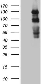 PLK4 Antibody in Western Blot (WB)