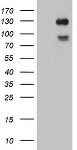 PLK4 Antibody in Western Blot (WB)