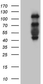 PLK4 Antibody in Western Blot (WB)