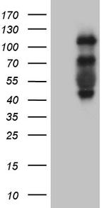 PLK4 Antibody in Western Blot (WB)