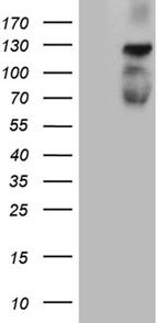 PLK4 Antibody in Western Blot (WB)