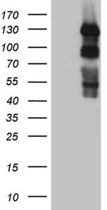 PLK4 Antibody in Western Blot (WB)
