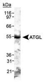 ATGL Antibody in Western Blot (WB)
