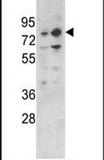 PLZF Antibody in Western Blot (WB)