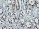 PMEL Antibody in Immunohistochemistry (Paraffin) (IHC (P))