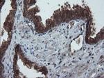 PMEL Antibody in Immunohistochemistry (Paraffin) (IHC (P))