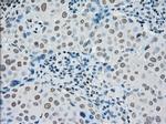 PMEL Antibody in Immunohistochemistry (Paraffin) (IHC (P))