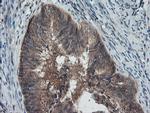PMEL Antibody in Immunohistochemistry (Paraffin) (IHC (P))
