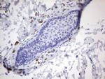 PMEL Antibody in Immunohistochemistry (Paraffin) (IHC (P))