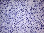 PMP22 Antibody in Immunohistochemistry (Paraffin) (IHC (P))