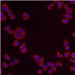 PMP70 Antibody in Immunocytochemistry (ICC/IF)