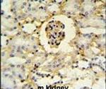 PMPCB Antibody in Immunohistochemistry (IHC)
