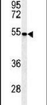 PMPCB Antibody in Western Blot (WB)