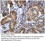 PMS2 Polyclonal Antibody