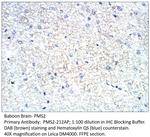 PMS2 Antibody in Immunohistochemistry (IHC)