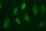 PMS2 Antibody in Immunocytochemistry (ICC/IF)