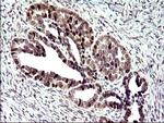 PMS2 Antibody in Immunohistochemistry (Paraffin) (IHC (P))