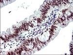 PMS2 Antibody in Immunohistochemistry (Paraffin) (IHC (P))