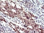 PMS2 Antibody in Immunohistochemistry (Paraffin) (IHC (P))